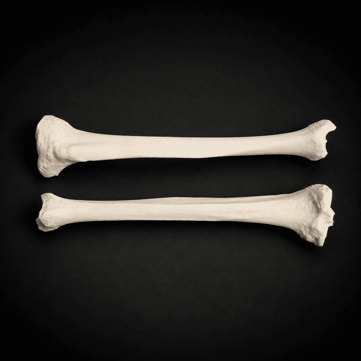 Tibia
