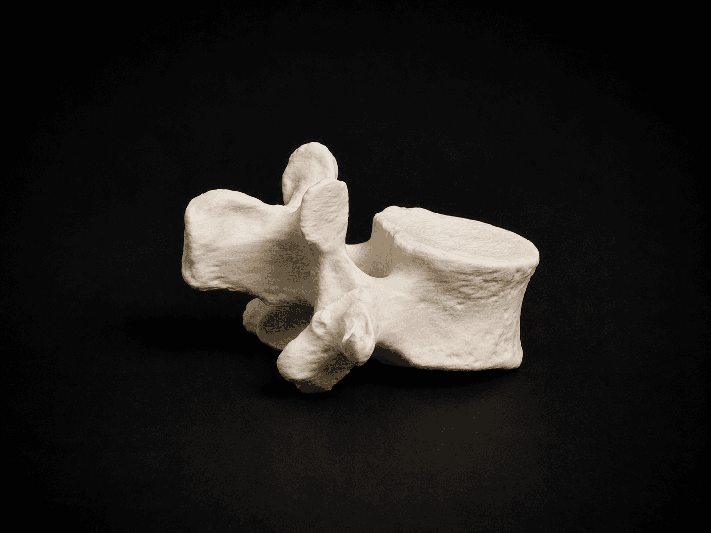 L1 Vertebra