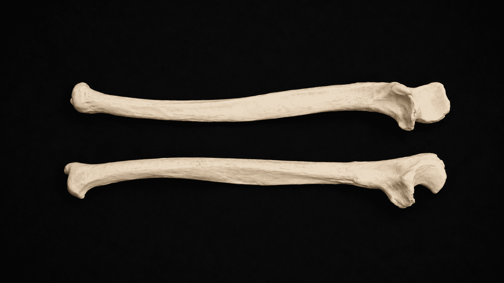 Ulna