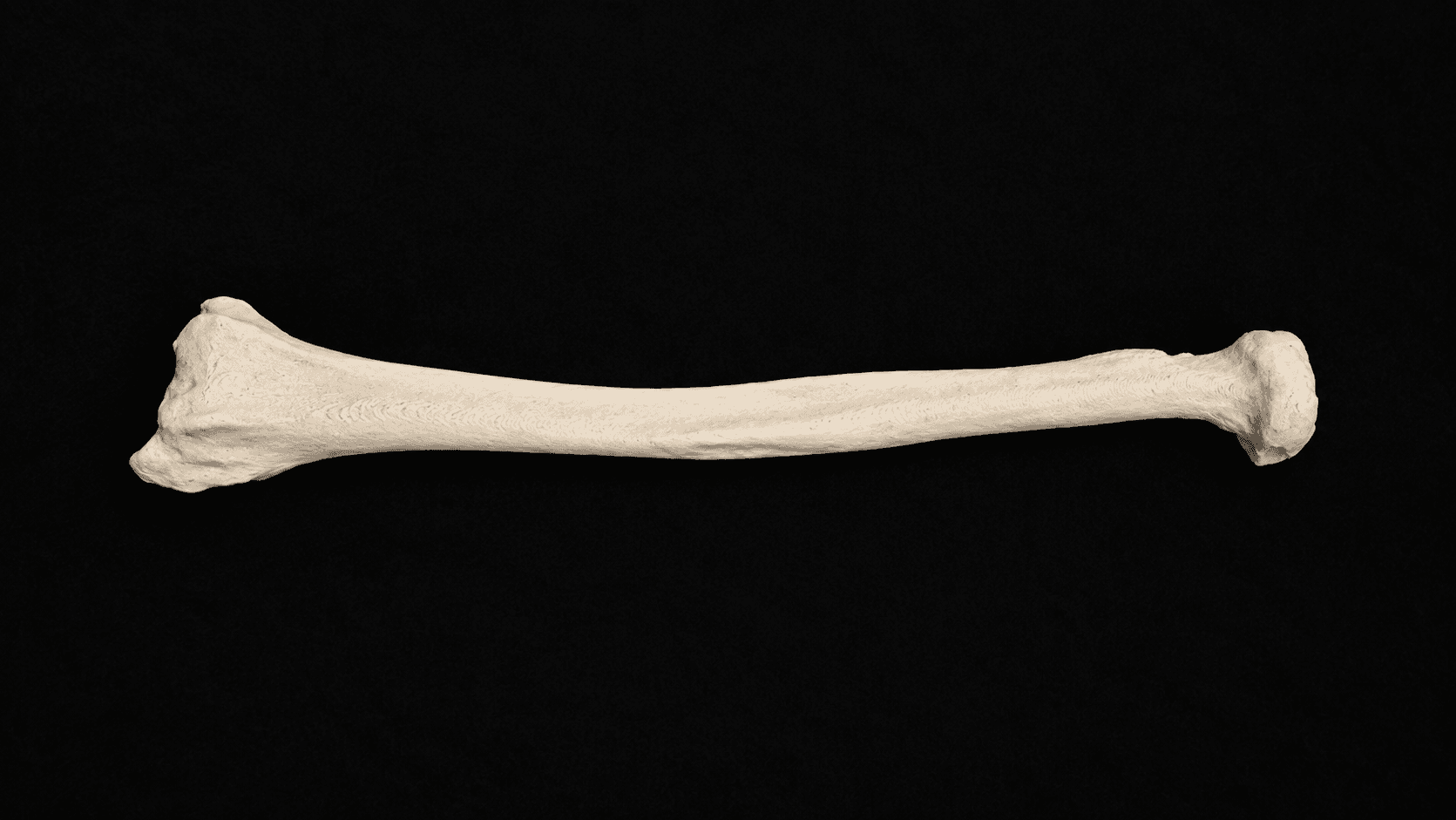 Radius