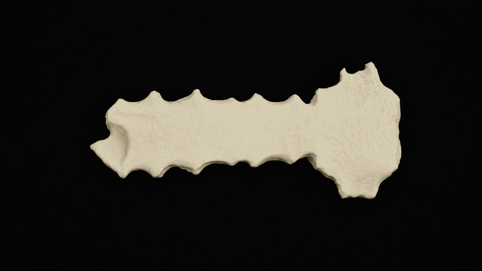 Sternum